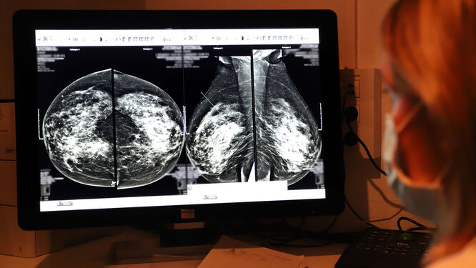 Featured image for “El hospital Juan Ramón Jiménez aumenta en un 14% las mamografías realizadas respecto a 2019”